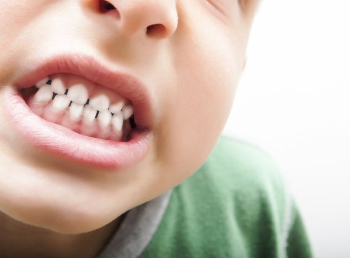 boy shows clenched teeth in close-up